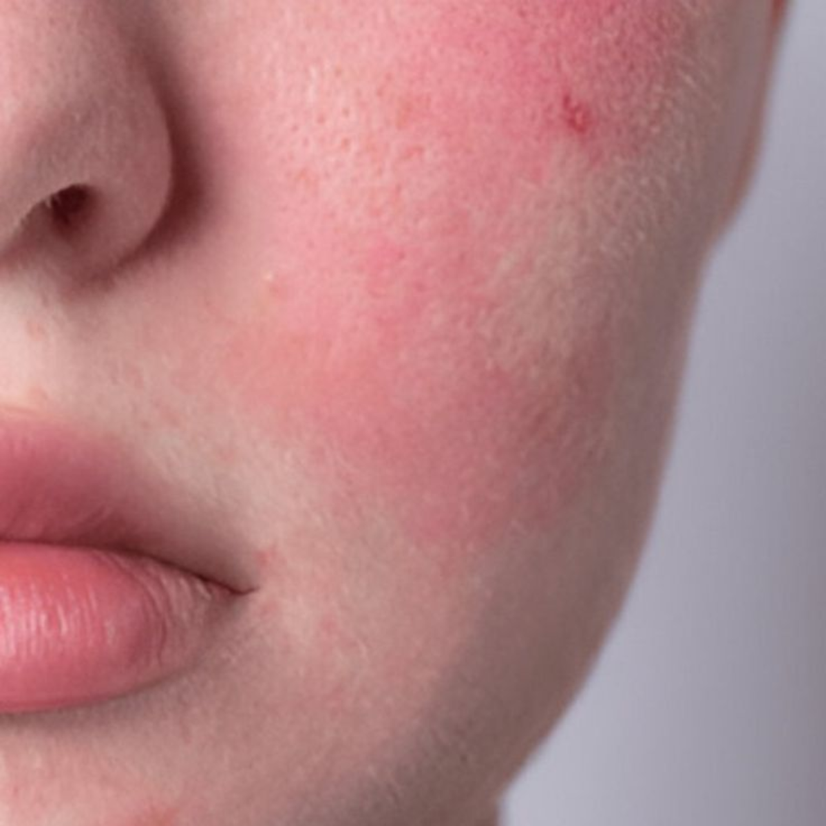 Sensitive Skin Care